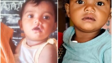 रायपुर : चिरायु दल ने लौटाई मासूम रंजना की मुस्कान