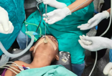 CG : गले से सिक्का निकाल डॉक्टरों ने बच्चे की जान बचाई …