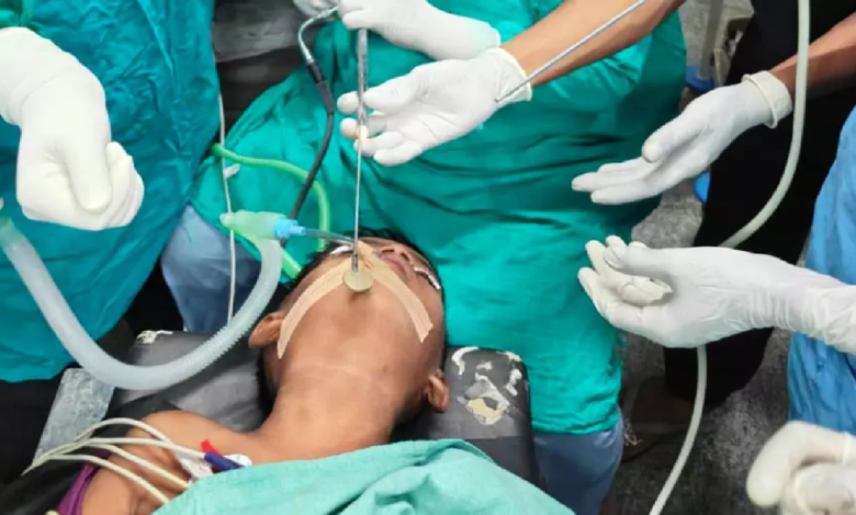 CG : गले से सिक्का निकाल डॉक्टरों ने बच्चे की जान बचाई …