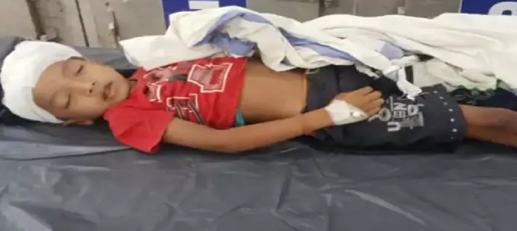 CG : शादी के दौरान हादसा, बिजली का खंभा गिरने से 6 साल के बच्चे की मौत …