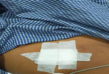 CG : मंदिर परिसर में चाकूबाजी, भाठागांव का मामला ...