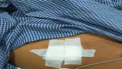 CG : मंदिर परिसर में चाकूबाजी, भाठागांव का मामला ...