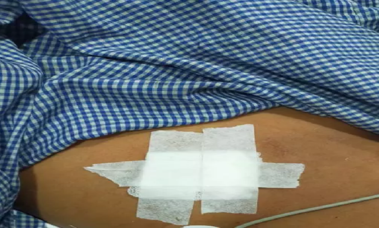 CG : मंदिर परिसर में चाकूबाजी, भाठागांव का मामला ...