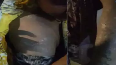 CG : किचन में लगी आग, गैस सिलेंडर का पाइप फटने से हुई बड़ी घटना, कई घायल …